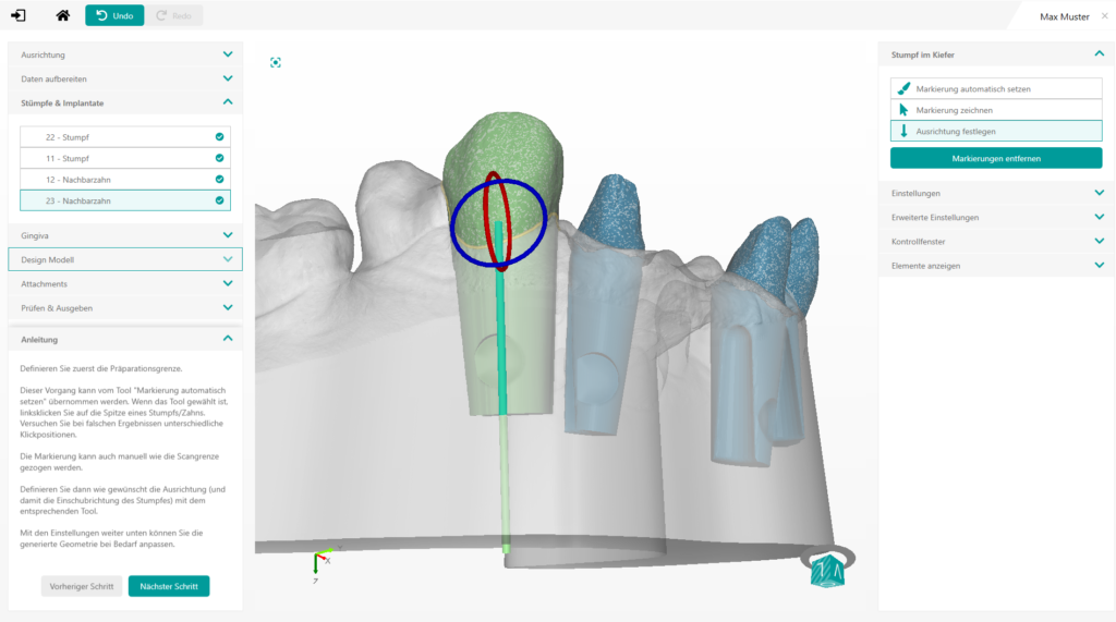 Software de captura de pantalla con la alineación del muñón